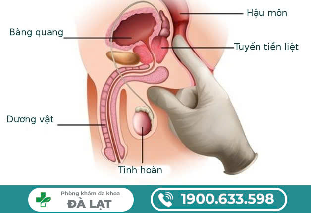 Hình ảnh minh họa